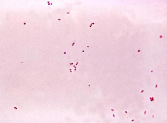 Meningococcus | Bacteria, Characteristics, & Meningococcal Meningitis |  Britannica