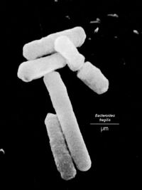 Bacteroides fragilis . From the [1]Zdravotni University