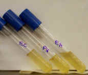 Gelatinase test. Notice the liquid medium in the tube on the right.