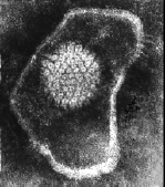 Herpes simplex virus 2