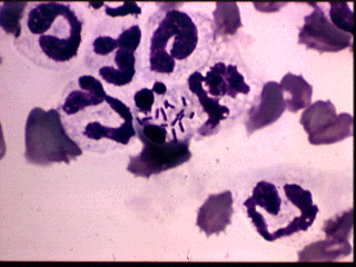 Listeria cells in monocytes