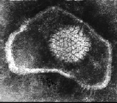 Herpes simplex virus 2